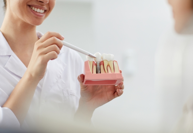 Implantaten bij een geslonken kaak